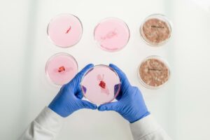 Jak groźna potrafi być salmonella? Kliknij po szczegóły!